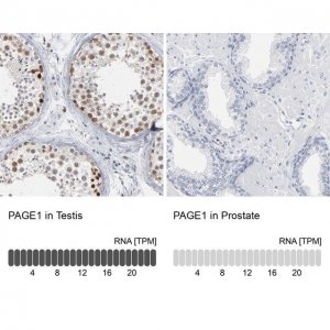 Anti-PAGE1 antibody produced in rabbit 