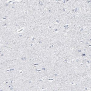 Anti-PAGE1 antibody produced in rabbit 