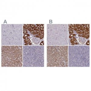 Anti-PAH antibody produced in rabbit HPA031642-100UL