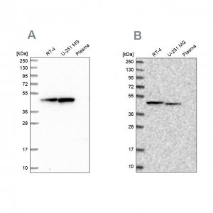 Anti-PAICS antibody produced in rabbit 