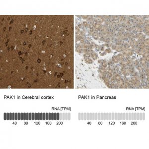 Anti-PAK1 antibody produced in rabbit 