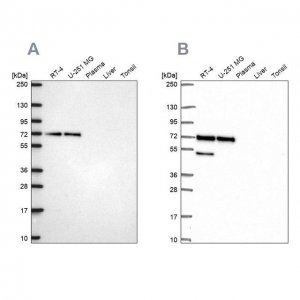 Anti-PAK4 antibody produced in rabbit 