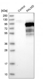 Anti-PALMD antibody produced in rabbit 