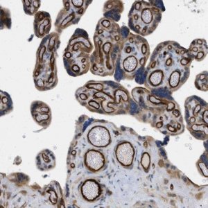Anti-PALMD antibody produced in rabbit 