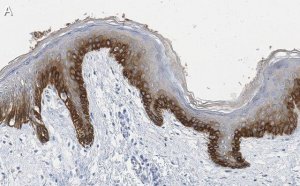 Anti-pan-cytokeratin Antibody, clone AE1 ZooMAb Mouse Monoclonal 