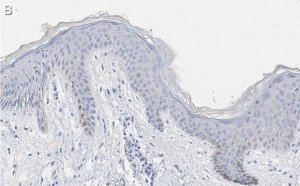 Anti-pan-cytokeratin Antibody, clone AE1 ZooMAb Mouse Monoclonal 