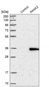 Anti-PANK2 antibody produced in rabbit HPA008440-100UL