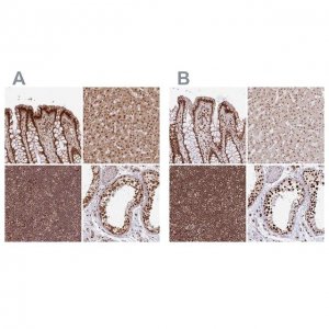 Anti-PAPD7 antibody produced in rabbit 