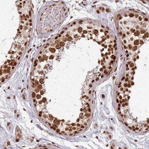 Anti-PAPD7 antibody produced in rabbit 