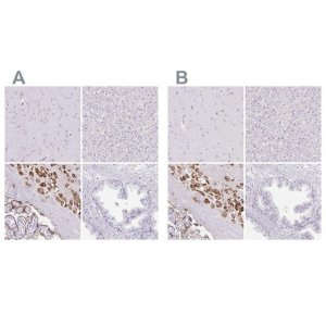 Anti-PAPPA2 antibody produced in rabbit 