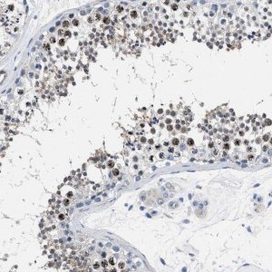 Anti-PARG antibody produced in rabbit 