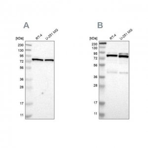 Anti-PARN antibody produced in rabbit HPA012010-100UL