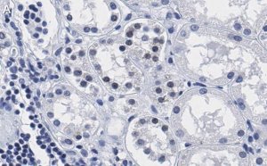 Anti-PARP-1 Antibody, clone 12N17 Antibody, ZooMAb Rabbit Monoclonal 