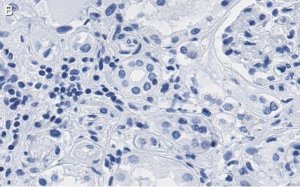 Anti-PARP-1 Antibody, clone 12N17 Antibody, ZooMAb Rabbit Monoclonal 
