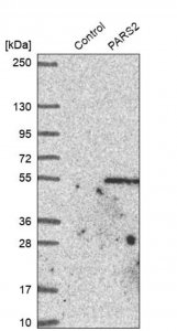 Anti-PARS2 antibody produced in rabbit HPA028314-100UL