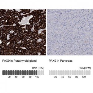 Anti-PAX9 antibody produced in rabbit 