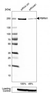 Anti-PBRM1 antibody produced in rabbit 