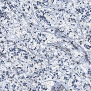 Anti-PBRM1 antibody produced in rabbit 