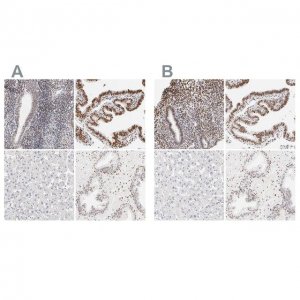 Anti-PBX1 antibody produced in rabbit 