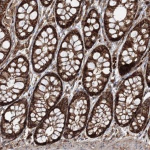 Anti-PCBD2 antibody produced in rabbit HPA036428-100UL