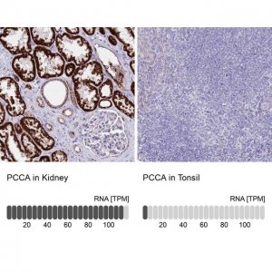 Anti-PCCA antibody produced in rabbit HPA047792-100UL