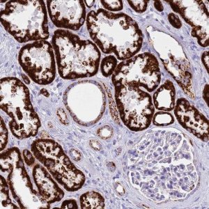 Anti-PCCA antibody produced in rabbit HPA047792-100UL
