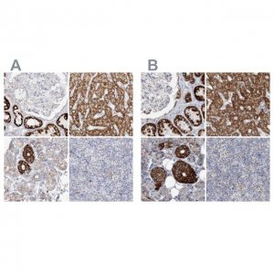 Anti-PCCB antibody produced in rabbit 