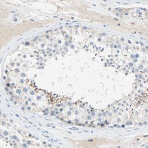 Anti-PCDHB2 antibody produced in rabbit 