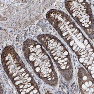 Anti-PCDHGA1 antibody produced in rabbit 