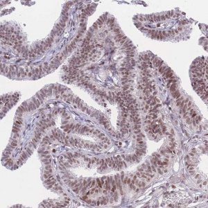 Anti-PCIF1 antibody produced in rabbit 