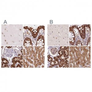 Anti-PCK2 antibody produced in rabbit 