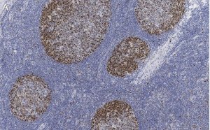 Anti-PCNA Antibody, clone 3B22 ZooMAb Rabbit Monoclonal 
