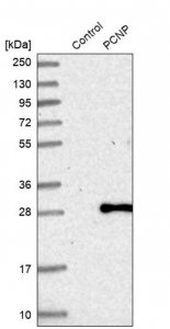 Anti-PCNP antibody produced in rabbit HPA035011-100UL