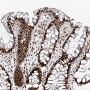 Anti-PCNP antibody produced in rabbit HPA035011-100UL