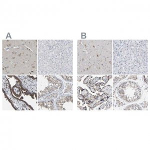 Anti-PCNT antibody produced in rabbit 