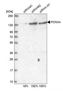 Anti-PCNX4 antibody produced in rabbit HPA002076-100UL