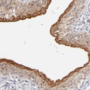 Anti-PCNX4 antibody produced in rabbit HPA002076-100UL