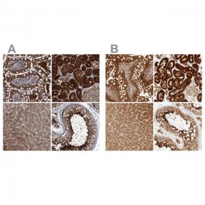 Anti-PCYT2 antibody produced in rabbit 