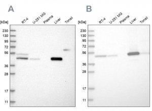 Anti-PCYT2 antibody produced in rabbit 