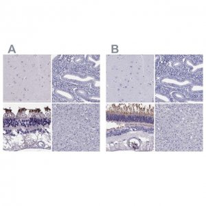 Anti-PDE6A antibody produced in rabbit 