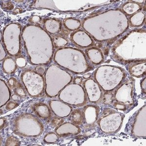 Anti-PDE8B antibody produced in rabbit 