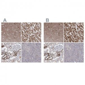 Anti-PDHB antibody produced in rabbit 