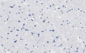 Anti-PDK4 Antibody, clone 2H5 ZooMAb Rabbit Monoclonal 