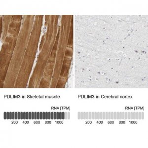 Anti-PDLIM3 antibody produced in rabbit 