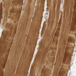 Anti-PDLIM3 antibody produced in rabbit 