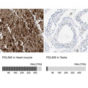 Anti-PDLIM5 antibody produced in rabbit 