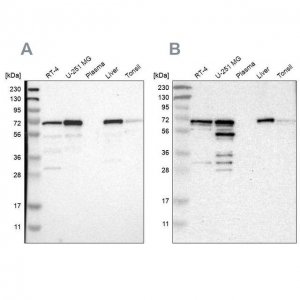 Anti-PDLIM5 antibody produced in rabbit 