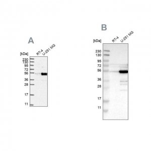 Anti-PDLIM7 antibody produced in rabbit 