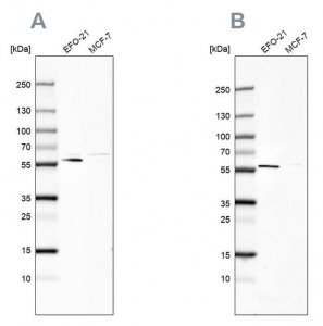 Anti-PDP1 antibody produced in rabbit HPA019081-100UL