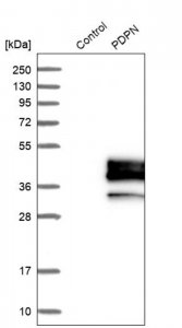 Anti-PDPN antibody produced in rabbit 